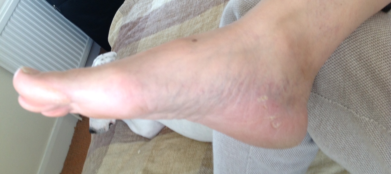 after.JPG